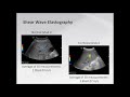 Liver Elastography