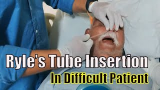 I Learned to Insert Ryle's Tubes Like a PRO in Just Minutes!