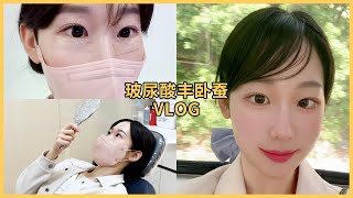 韩国 卧蚕玻尿酸后记📺 | 恢复视频 |玻尿酸Vlog