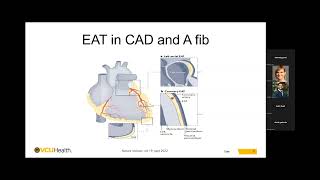Pauley Heart Center Cardiology Grand Rounds - May 30, 2024