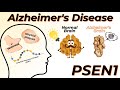 The real story behind Alzheimer’s Disease and PSEN1