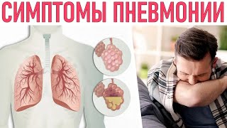 НЕ ПРОПУСТИ ОПАСНЫЕ СИМПТОМЫ | 11 симптомов пневмонии которые нельзя пропустить