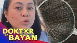 DANDRUFF: Makating Anit at Tamang Gamutan - Payo ni Doc Liza Ramoso-Ong #82b