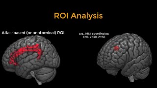 fMRI Short Course #9: ROI Analysis