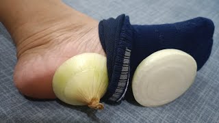 Onions in Socks: Natural Relief for Cold and Flu!