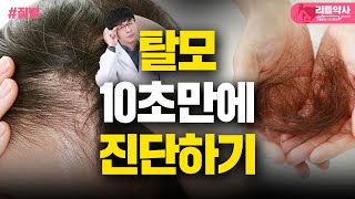 10초면 탈모를 자가진단할 수 있다! 헤어라인 후퇴? 탈모인지 아닌지 확인해보세요(남성탈모 여성탈모 증상, 탈모 영양제)