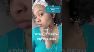 Dites adieu les taches avec le nouveau peeling de L’Oréal Paris 🐍