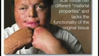 Lecture: Stem Cells and Tissue Regeneration