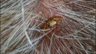 Tick Meat Allergy