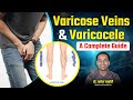 Varicose Veins & Varicocele: Symptoms and Best Treatment Methods in Hindi By Dr. Amol Lahoti