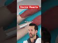 er doctor reacts to