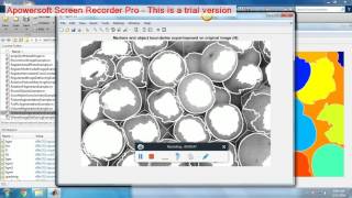 MATLAB WATERSHED SEGMENTATION