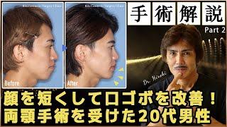 顔の長さがコンプレックスで両顎手術を受けた20代男性の手術内容を解説します②【リッツ美容外科】