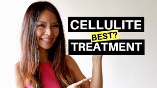 Cellulite Treatment Before And After: Venus Legacy Cellulite Treatment