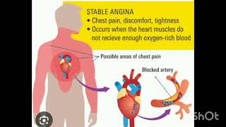 Egi ka cardiac Life apnaye or ❤️ heart ki samsya se chutkara  paye  order now