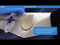 How to Remove PICC Line: Step 1 - Lisa A. Gorski | Medbridge