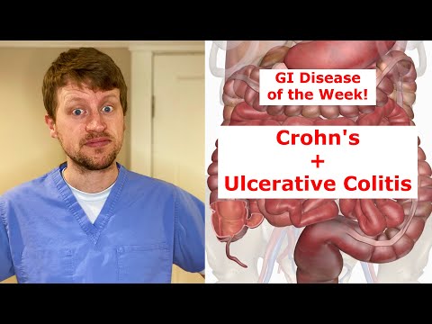 Can you see inflammation with a colonoscopy?