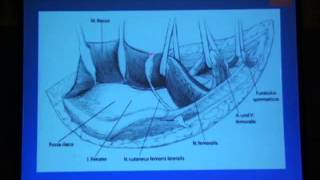 15 Ilioinguinal approach   Rommens