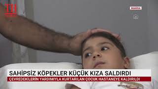 SAHİPSİZ KÖPEKLER KÜÇÜK KIZA SALDIRDI