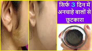 सिर्फ 5 मिनट में अनचाहे बालों से हमेशा के लिए छुटकारा पाएं | Home Remedies For Unwanted Hair