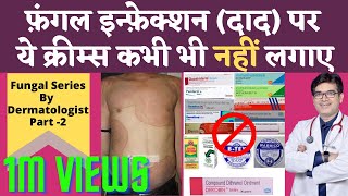 Ringworm Fungal Infection Treatment In Hindi | Fungal Infection Cream Without Steroids | Dr Sunil