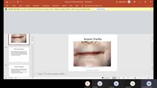 CH 17 Oral Pathology Part 1