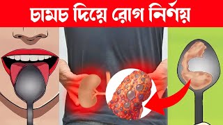 আপনার শরীরে কি কোনও রোগ আছে? চামচ দিয়ে জেনে নিন!