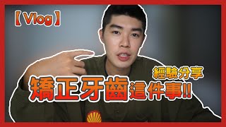 【Vlog】矯正牙齒這件事!!阿排經驗分享