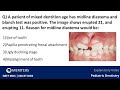 NEET MDS | INICET - Pediatric Dentistry | Explanatory Video | Past Year Questions | MERITERS