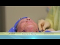 ThermiTight Procedure - La Jolla Cosmetic Laser Clinic