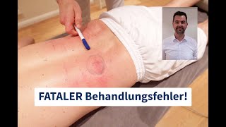 Chiropraktik | Fataler Behandlungsfehler! | mit Timo | deutsch | #71