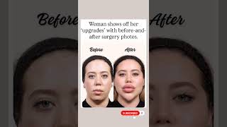 She went viral after showing her before-and-after transformation photos 😳✨ #shorts #viral