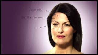 The Juvederm Range