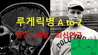 루게릭 병의 이해: 원인부터 최신 연구까지[Understanding Lou Gehrig's Disease: From Causes to Latest Research]