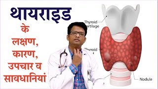 Thyroid disease-  causes, symptoms & treatment | थायराइड के लक्षण, कारण, उपचार व सावधानियां