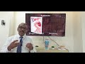 Patulous eustachian tube (Urdu) Patient teaching programme