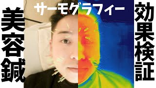 【美容鍼】最強！本当のビフォーアフターはコレだ!!