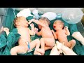 triple newborn baby just after weight 3.4 2.5 2.4 kg