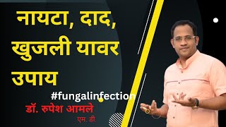 नायटा, दाद, खुजली यावर उपाय Fungal Infection By Dr. Rupesh Amale