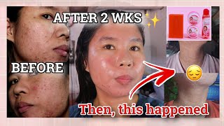 MY FIRST TIME TO USE REJUV SET | Brilliant Skin Rejuvenating Set Experience! Effective nga ba?!