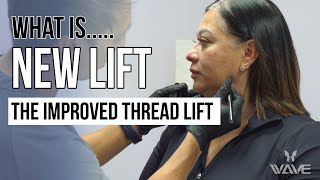 What is... New Lift - The Improved Thread Lift | Wave Plastic Surgery