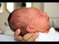 Portland OR Cone Head Baby Adjustment with Dr. Siegfried’s Bilateral Nasal Specifics Portland OR Cone Head Baby Adjustment with Dr. Siegfried’s Bilateral Nasal Specifics