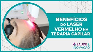 Benefícios do Laser Vermelho na Terapia Capilar