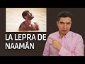 Suelta el orgullo - La lepra de Naamán | Prédicas cristianas | Nicolás Ramos