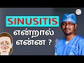 SINUSITIS என்றால் என்ன ? | SINUSITIS in Tamil | Dr. Manoj ENT Speciality Centre | Trichy