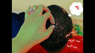 Battle of the flakes | Dandruff Scratching |