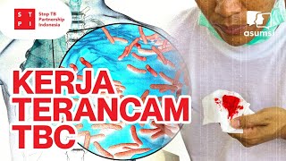 Ancaman TBC di Usia Produktif