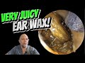 VERY JUICY EAR WAX! 290 #ear #earwax #earwaxremoval #earcleaning #fyp #asmr #foryou #satisfying