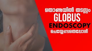 തൊണ്ടയിൽ തടസം  Globus I Endoscopy ചെയ്യേണ്ടതെപ്പോൾ