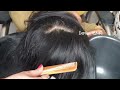 dandruff scratching removal with soft asmr hair scalp check 117